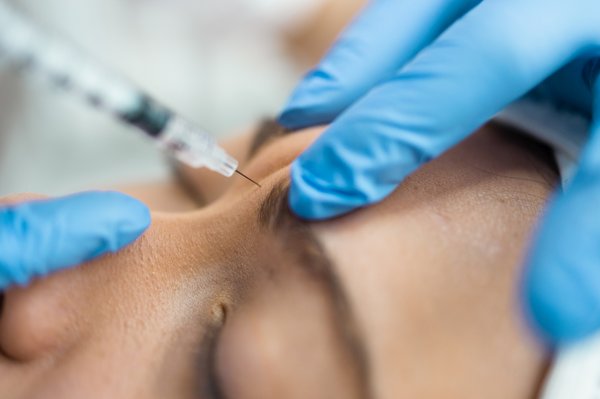 Révélez votre jeunesse grâce aux injections d'acide hyaluronique